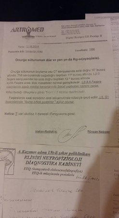  “Zəngilan İcra Hakimiyyətindən mənə 4 aydan bir 100 manat verirlər ki, get yaşa, axı necə yaşayım?”