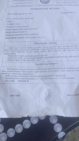 “Dövlətimdən pensiya istəyirəm, düşmürsə, onda məni işlə təmin etsinlər" “Dövlətimdən pensiya istəyirəm, düşmürsə, onda məni işlə təmin etsinlər"